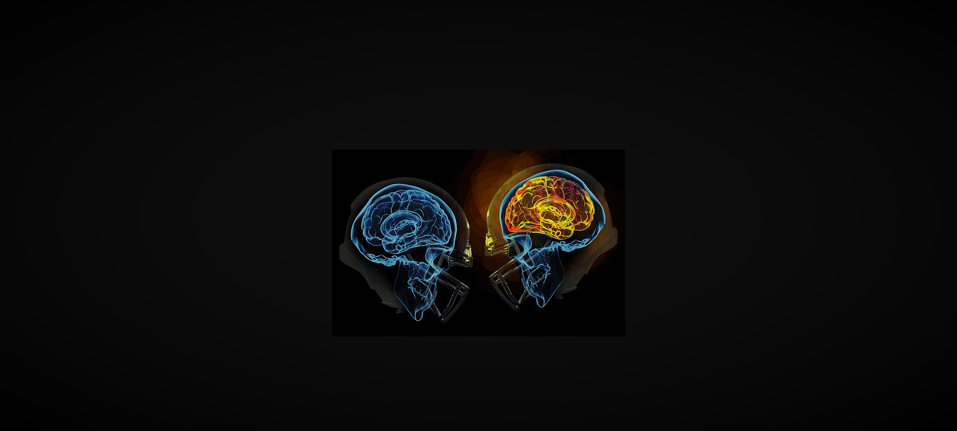 Chronic Traumatic Encephalopathy (CTE)